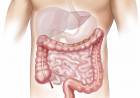 Bağırsak Hastalıkları