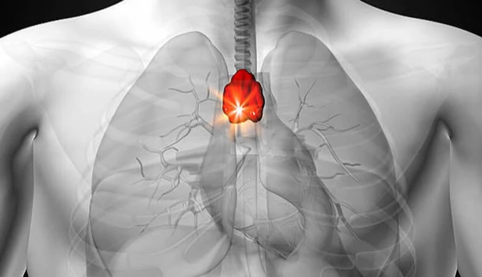 Timus Bezi Nedir? Timus Bezi Ne İşe Yarar?