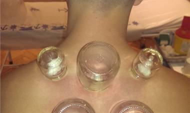 Hacamat Nedir? Hacamat Nasıl Yapılır?