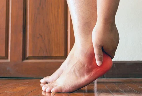 Topuk Dikeni Bitkisel Tedavisi Ve Doğal Çözüm Yolları Nelerdir?