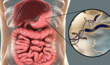Helikobakter Pilori Nedir, Belirtileri Nelerdir? Bitkisel Tedavisi Nasıl Yapılır?