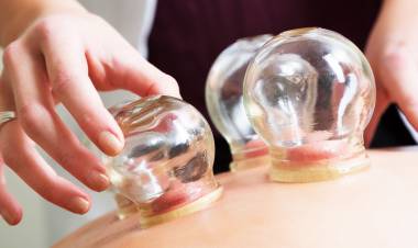 Hacamat Nedir? Hacamatın Faydaları Nelerdir?