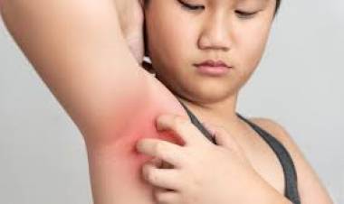 Koltuk Altı Kaşıntısı ve Döküntüsüne Ne İyi Gelir?